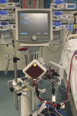 Etwa 35 Patienten werden im Helios Klinikum Erfurt pro Jahr mittels ECMO-Therapie versorgt. Die Abkürzung ECMO steht für „extrakorporale Membranoxygenierung“ und meint eine „Sauerstoffaufnahme über eine Membran außerhalb des Körpers“. 