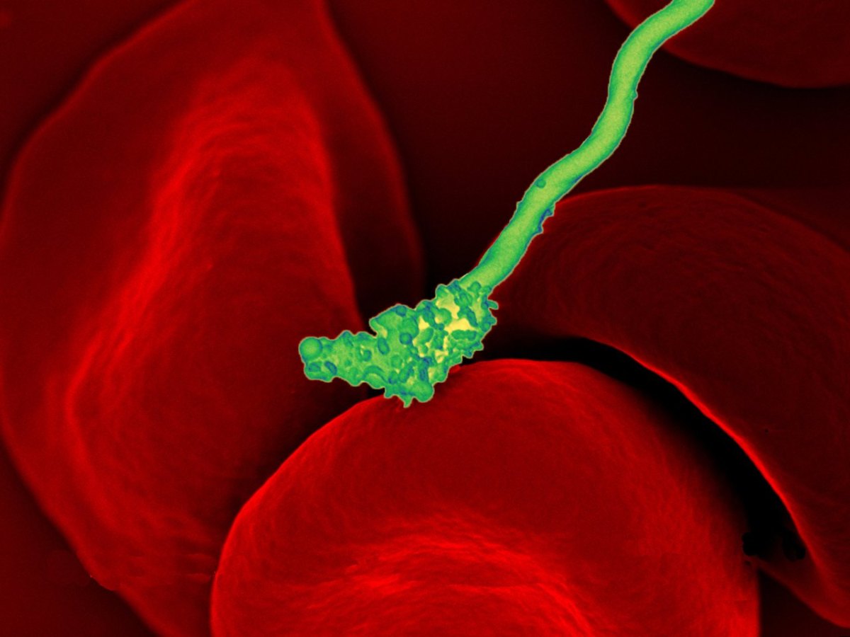 thüringen borreliose.jpg